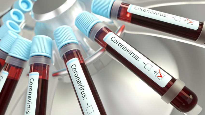 En Salta, 30 casos sospechosos han dado negativos a coronavirus
