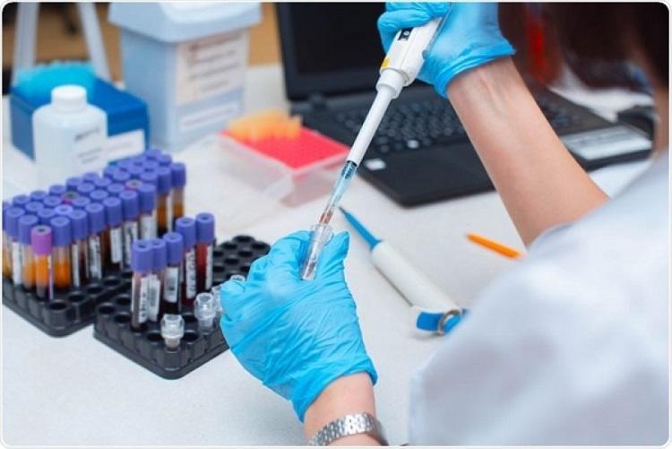 Este domingo se registraron 40 casos de coronavirus en Salta