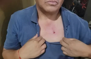 Nuevo ataque con cadena a un inspector municipal en Plaza 9 de Julio